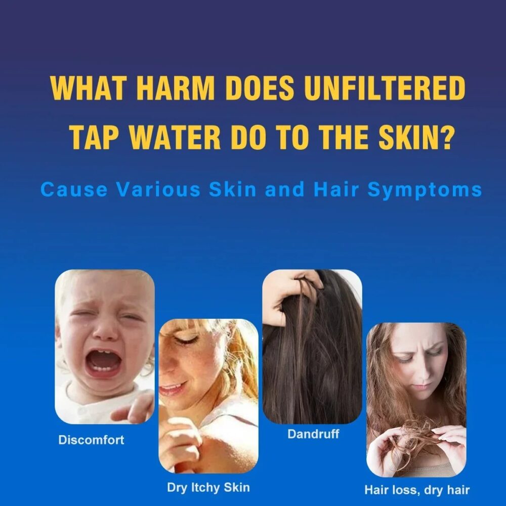 ALTHY Vitamin C Revitalizing Shower Water Filter – Reduces Chlorine & Heavy Metals for Healthier Skin, Hair & Scalp – Relieves Dryness, Dandruff & Eczema | Wiloria